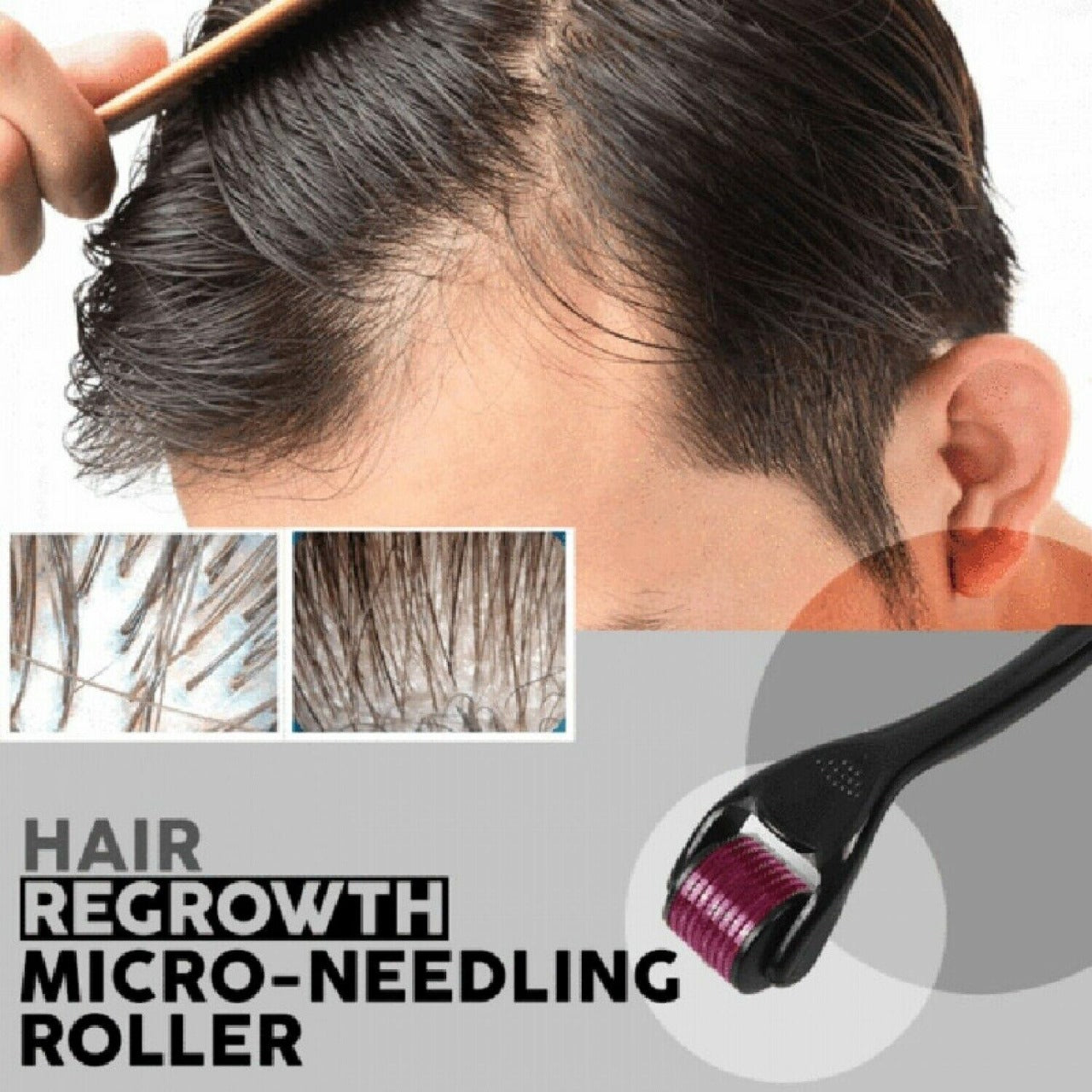 Titanium Microneedle Derma Roller for Face, Beard & Hair Growth